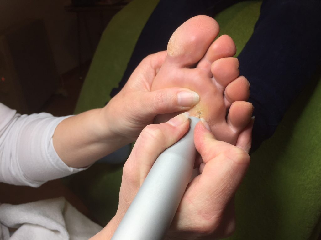 pedicure