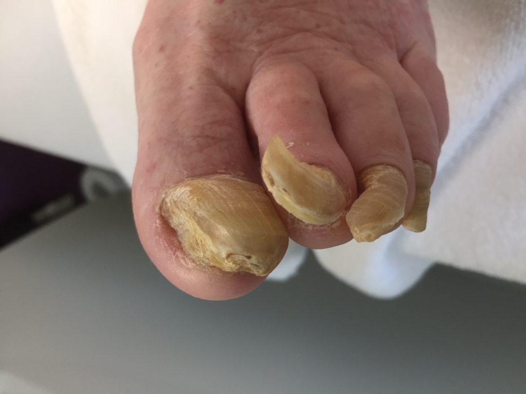 pedicure