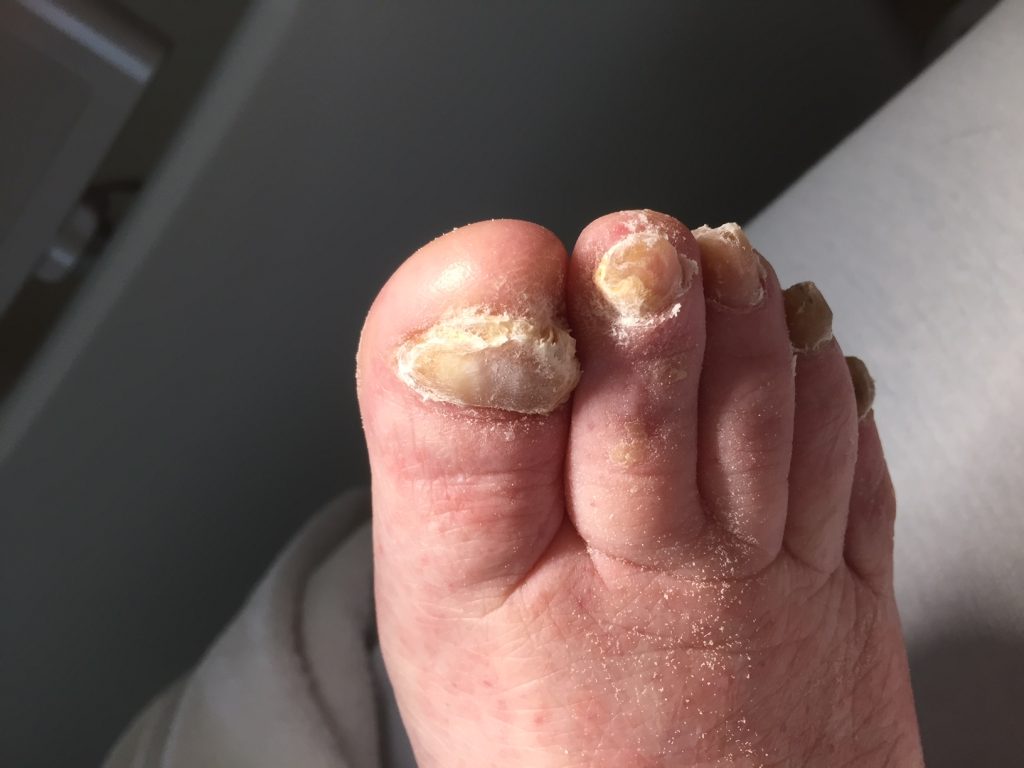 pedicure